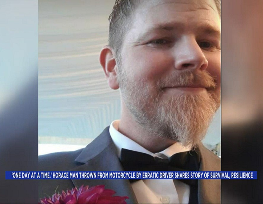 Motorcycle Accident Victim Gives Credit to HBOT HBOT News