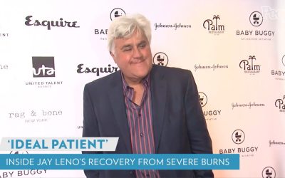 What to Know About the HBOT Chamber Jay Leno Used for Burn Treatment
