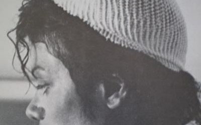 HBOT for Burns, on the Anniversary of Michael Jackson’s Pepsi Commercial Burn Incident